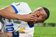 FOTO. Kilian Mbappe singan burni bilan Franciya mashg'ulotlarida qatnashmoqda 