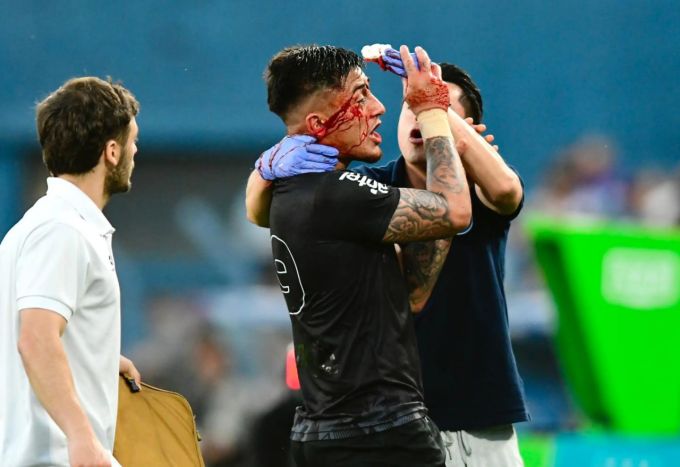 Юзи қонга беланган ва агентидан нолиган "Динамо"нинг уругвайлик футболчиси билан танишамиз